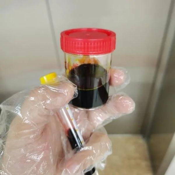急性肝衰竭！兩兄弟誤吃這種菌 專家提醒