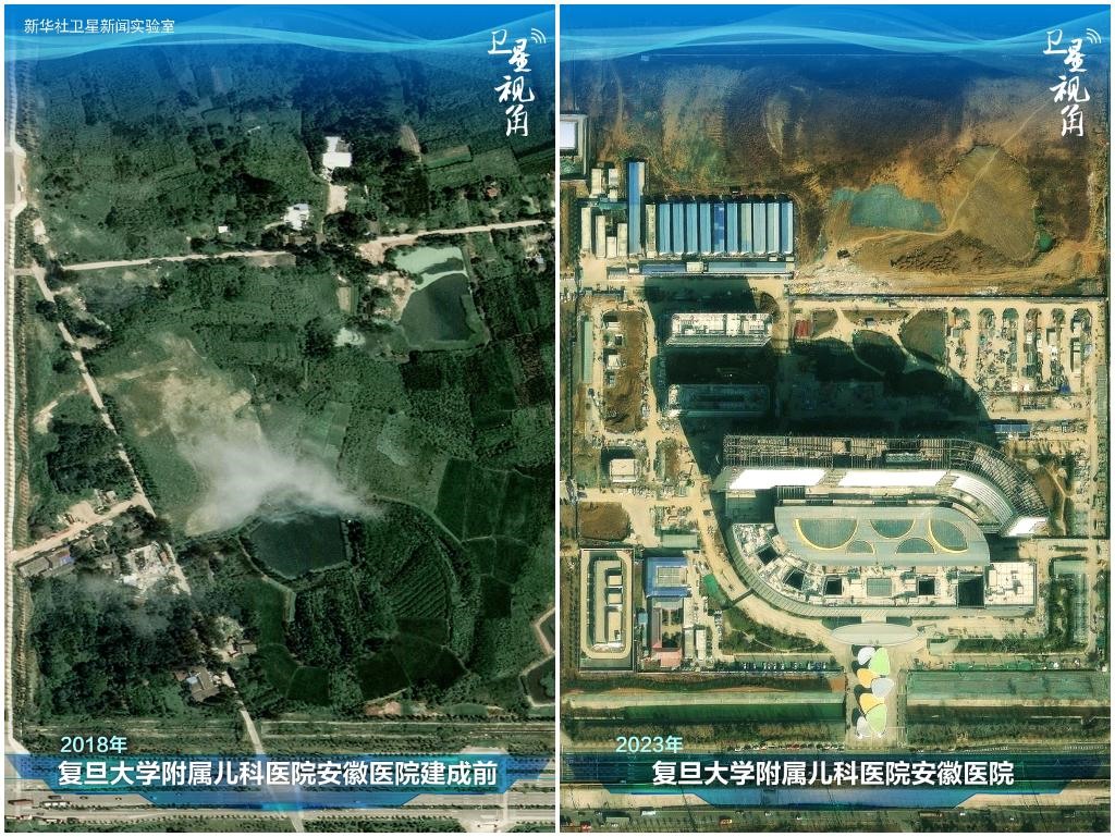 2023年與2018年相比，復(fù)旦大學(xué)附屬兒科醫(yī)院安徽醫(yī)院從一片荒地到建成投用。該項(xiàng)目是安徽省在長三角一體化高質(zhì)量發(fā)展衛(wèi)生健康領(lǐng)域的重大項(xiàng)目，也是安徽首批落地的國家區(qū)域醫(yī)療中心。